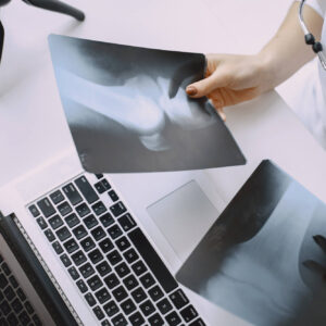 ubezpieczenie Compensa Zdrowie pakiety medyczne DobraPolisa24pl